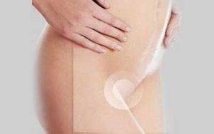 Genitalia Surgery Delhi