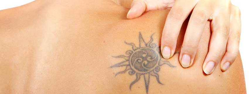 Discover more than 68 tattoo removal in mumbai best  thtantai2